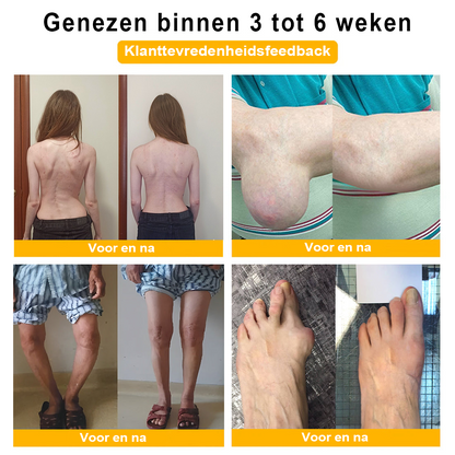 Cvreoz™ Bijengif Gewrichtstherapie Crème ( ✨ Bijzonder voor ouderen, aanbevolen door EULAR ✨ )