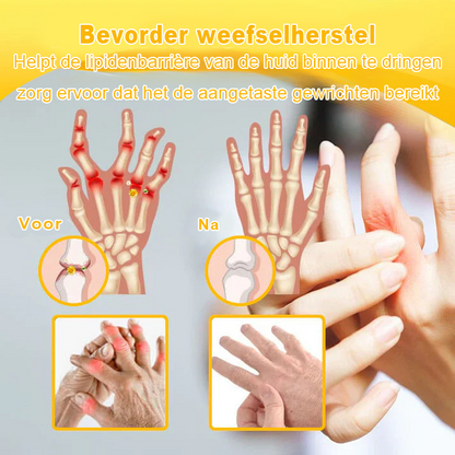 Cvreoz™ Bijengif Gewrichtstherapie Crème ( ✨ Bijzonder voor ouderen, aanbevolen door EULAR ✨ )