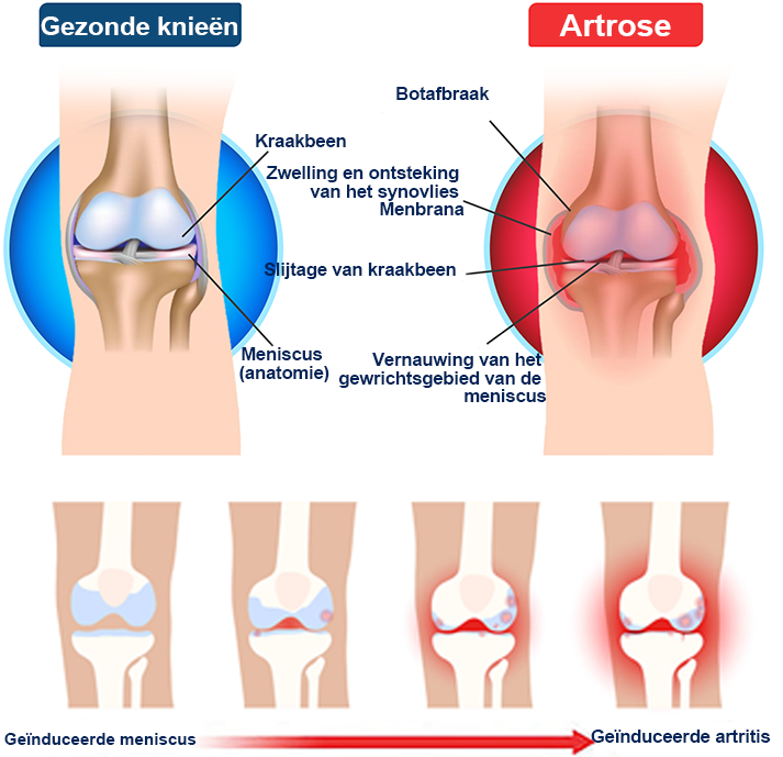 𝐀𝐞𝐞𝐡𝐟𝐞𝐧𝐠™ Bijengif en kurkuma Artritiscrème (Specialisatie in orthopedische aandoeningen en gewrichtspijn)🌟