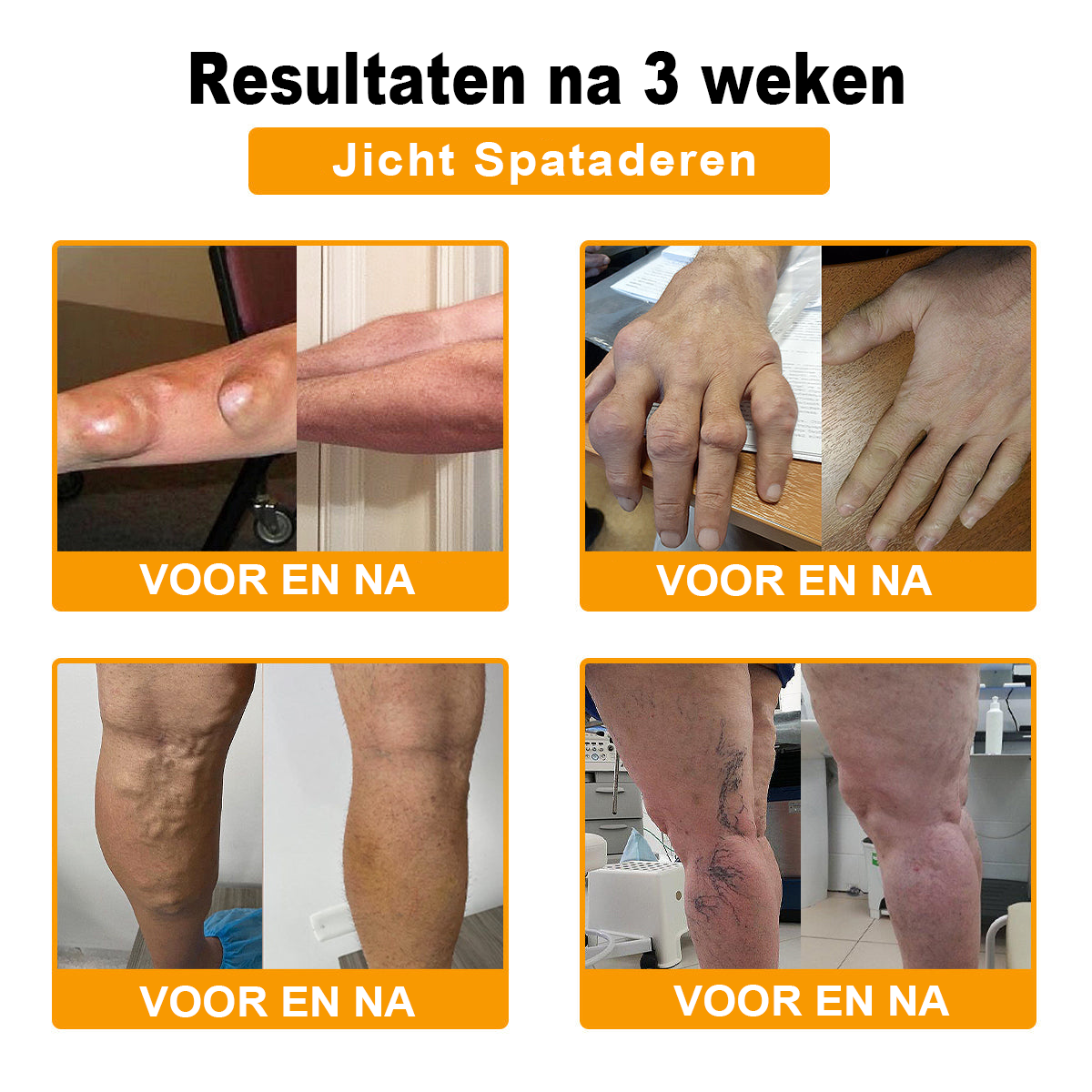 Cvreoz™ Bijengif Gewrichtstherapie Crème ( ✨ Bijzonder voor ouderen, aanbevolen door EULAR ✨ )