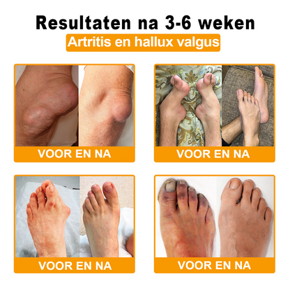 Cvreoz™ Bijengif Gewrichtstherapie Crème ( ✨ Bijzonder voor ouderen, aanbevolen door EULAR ✨ )